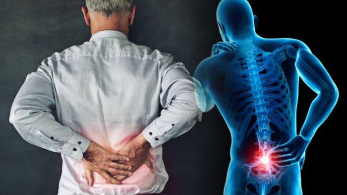 Mengenal Osteoporosis: Penyebab, Gejala, dan Cara Mengatasinya_trends.co.id